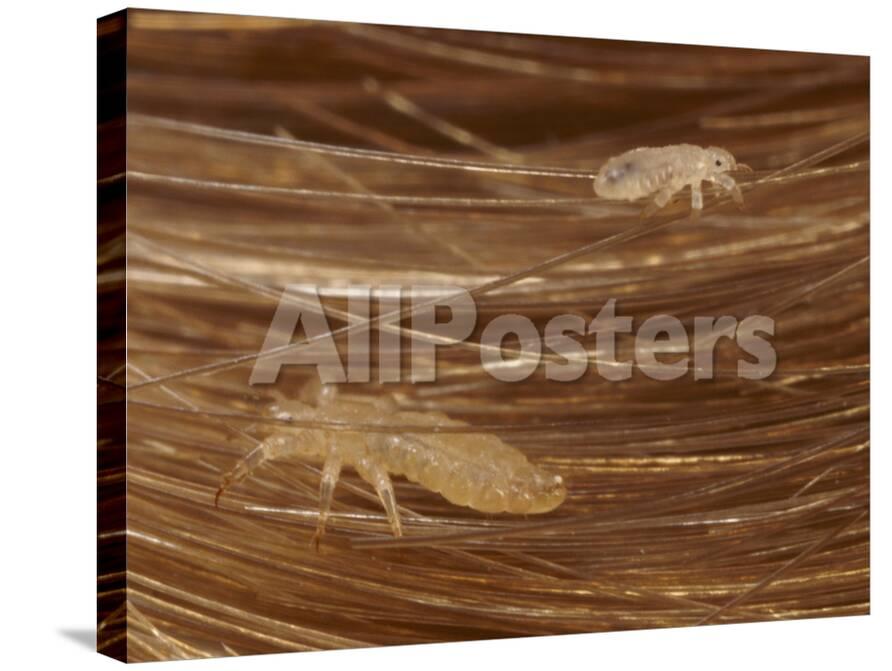 Head Lice Crawling Through Hair Photographic Print By Darlyne A