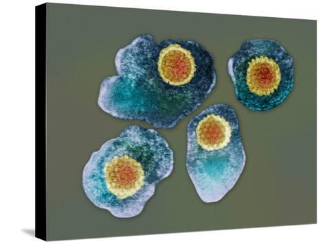 The Varicella-Zoster Viruses Is from the Herpes Family and Causes
