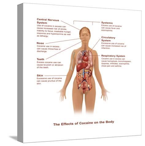 causes and effects of using cocaine causes and effects of using cocaine