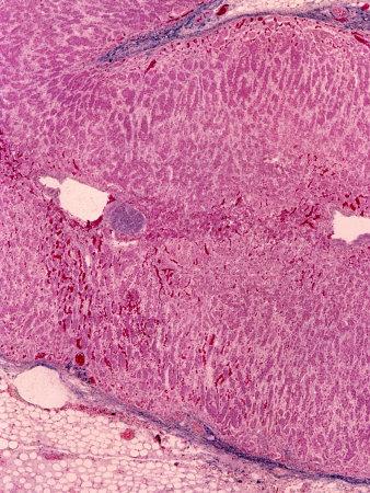 adrenal cortex medulla adrenal cortex medulla
