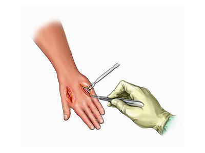 compartments of the hand