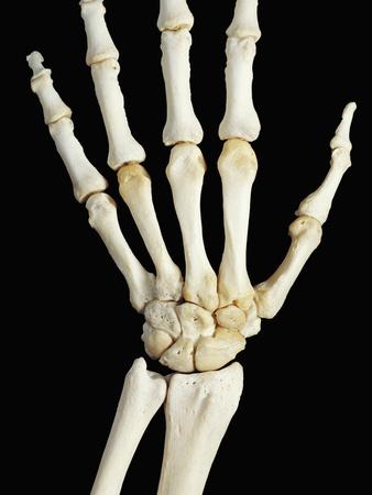 'Bones of the Human Right Hand, Wrist, and Lower Arm (Radius and Ulna