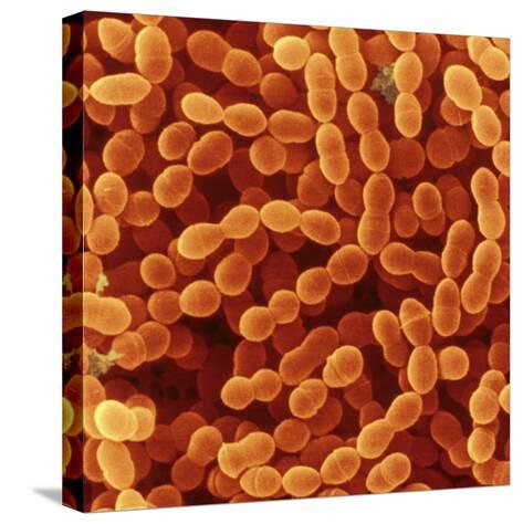 Resultado de imagen para Streptococcus thermophilus: