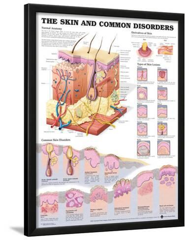 The Skin And Common Disorders Anatomical Chart