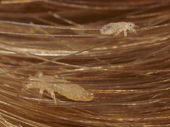 Head Lice Crawling Through Hair Photographic Print By Darlyne A