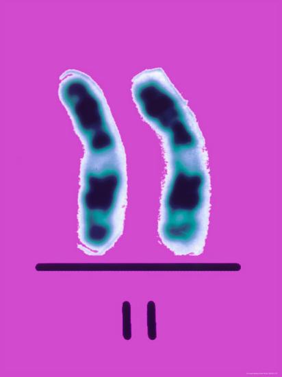 'Chromosome 11 Gene Therapy Sickle Cell Anemia ...