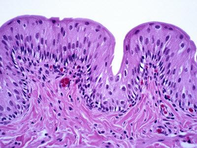 'Transitional Epithelium of the Urinary Bladder, H&E Stain