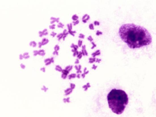 'Human Male Chromosome Spread Next to Cells. Brightfield' Photographic