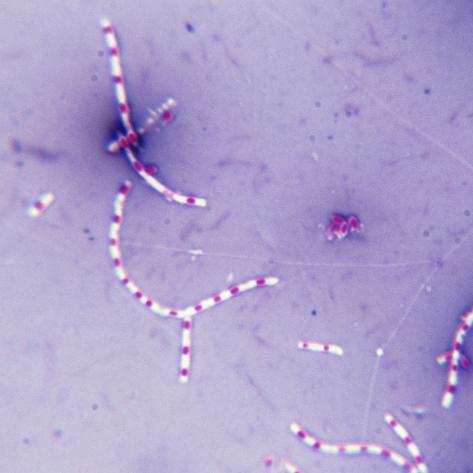 spore stain spore stain