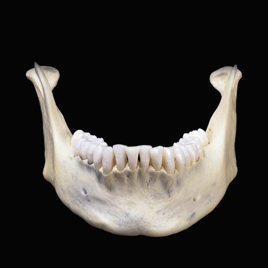 'The Human Lower Jaw Bone or Mandible Is the Largest and Strongest Bone