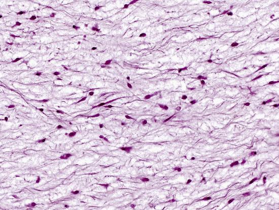 'Mesenchyme Embryonic Connective Tissue, H&E Stain, LM X200
