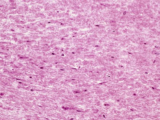 Whartons jelly connective tissue