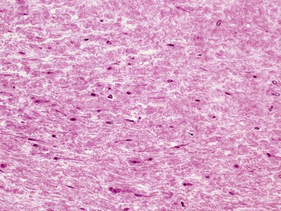 Whartons jelly connective tissue