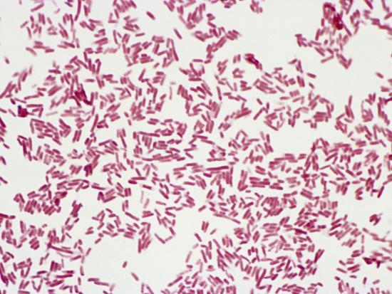 'E. Coli Bacteria, Gram-Negative Bacilli. Gram Stain, LM ...