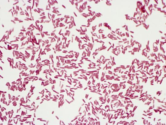 what color is e coli what color is e coli