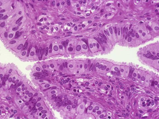 Human Fallopian Tube Lined by Ciliated Columnar Human Fallopian Tube Lined by Ciliated Columnar