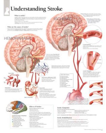 Poster, , small