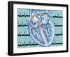 Atrial Fibrillation-John Bavosi-Framed Photographic Print