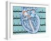 Atrial Fibrillation-John Bavosi-Framed Photographic Print