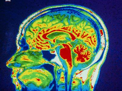 Photographic Print, , small