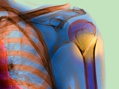 Photographic Print, , small