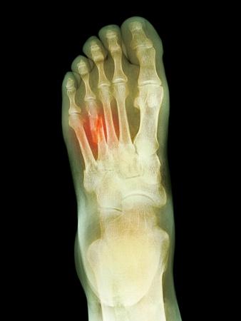 Photographic Print, , small