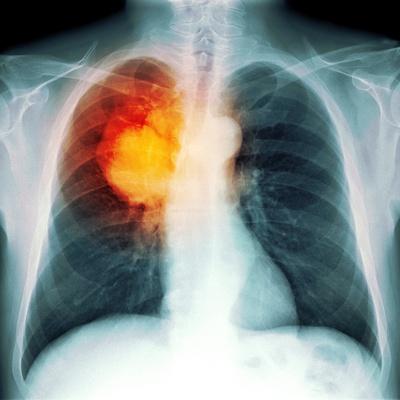 Photographic Print, , small