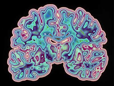 Photographic Print, , small