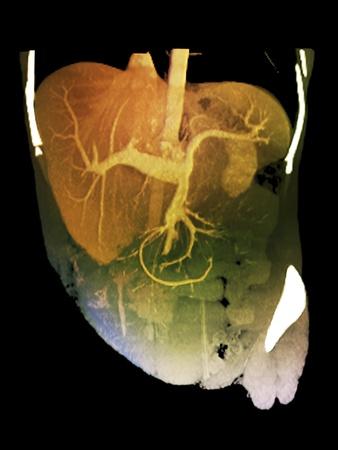 Photographic Print, , small