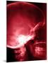 X-Ray of Human Skull-null-Mounted Photographic Print